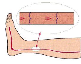 这5类人请立刻停止热水泡脚